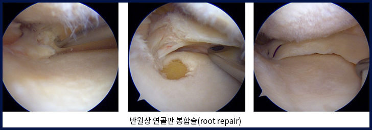 수술이 필요한 경우