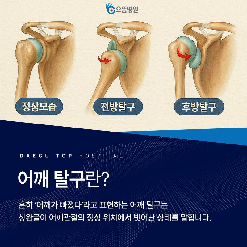 어깨 탈구 진료