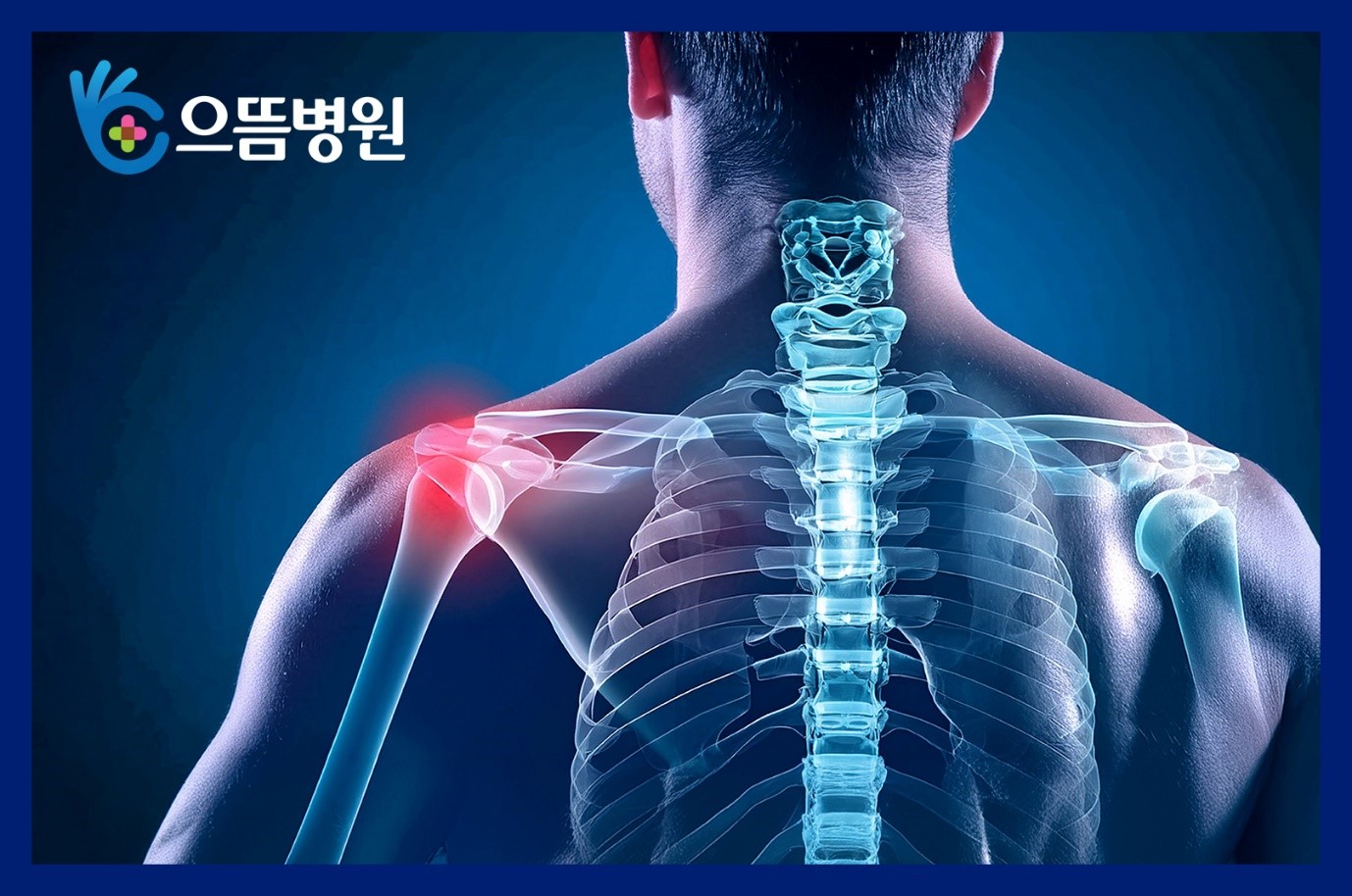 어깨 탈구의 위험성