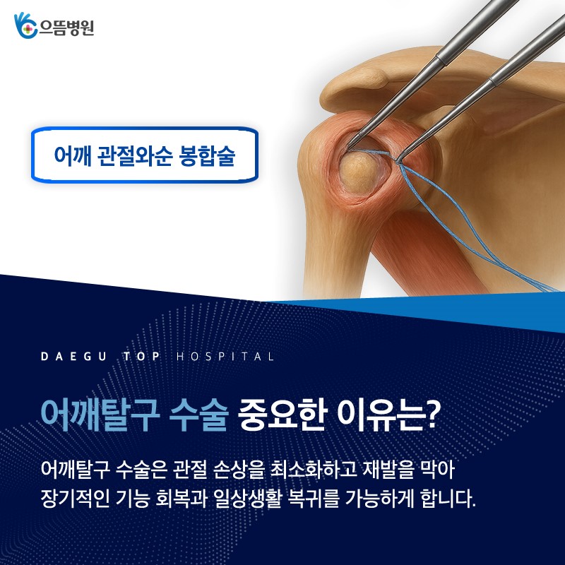 정밀 진단 장비